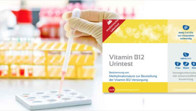 Vitamin B12 Mangel Urintest