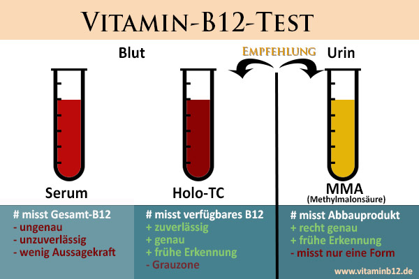 Vitamin-B12-Test